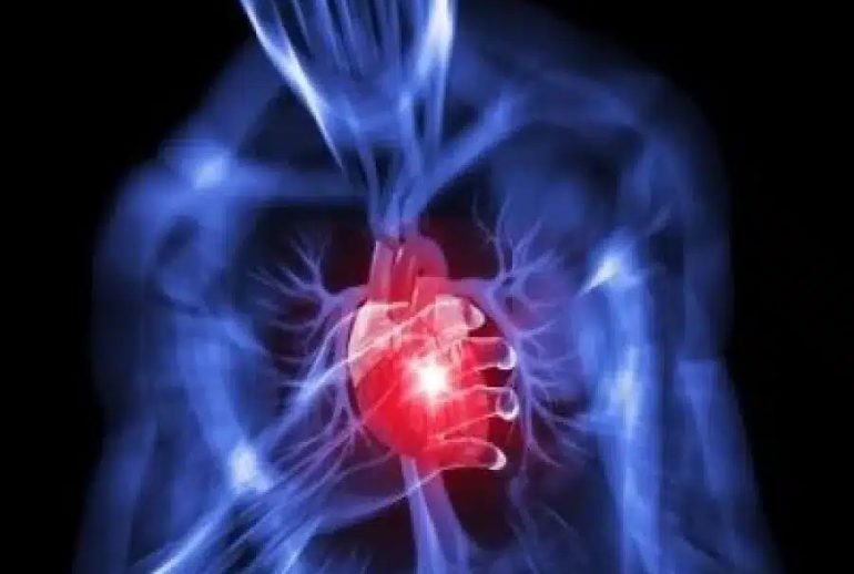 دکتر سندرم قلب شکسته - تهران