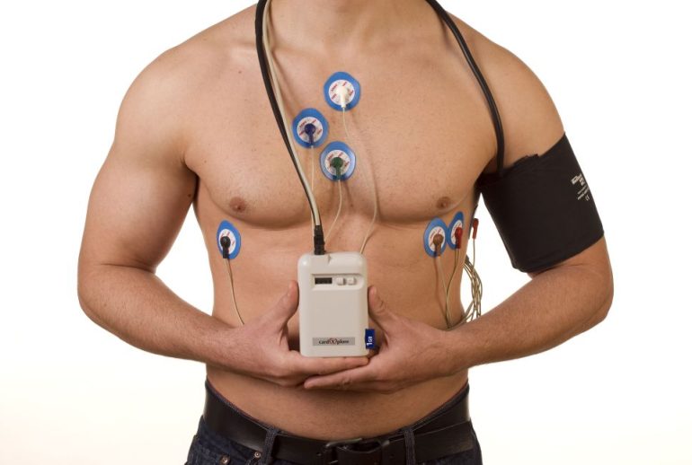 دکتر نصب هولتر قلب - تبریز